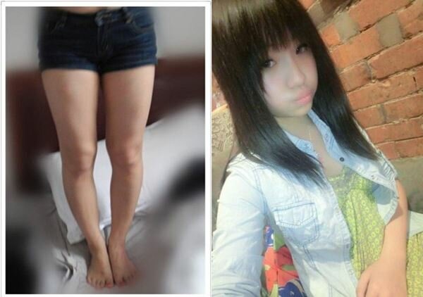 Японская девушка сделала операцию, чтобы удлинить ноги Фотографии